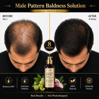 NOVA Ayurvedic Black Hair Oil - 50ml